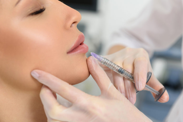 Injectare cu acid hialuronic pentru marirea buzelor